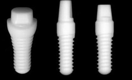 dental-implant-img